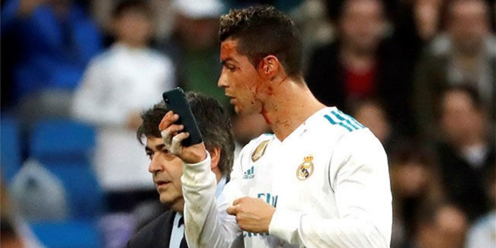 Cristiano Ronaldo reaccion&oacute; curiosamente tras recibir un fuerte golpe
